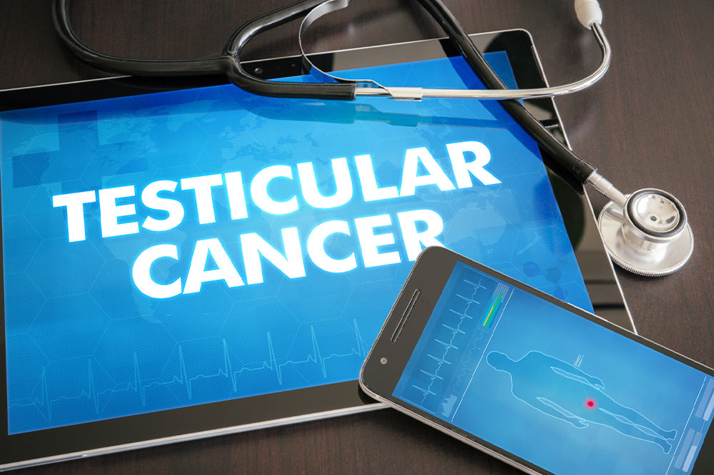 A Brief Overview of Testicular Cancer