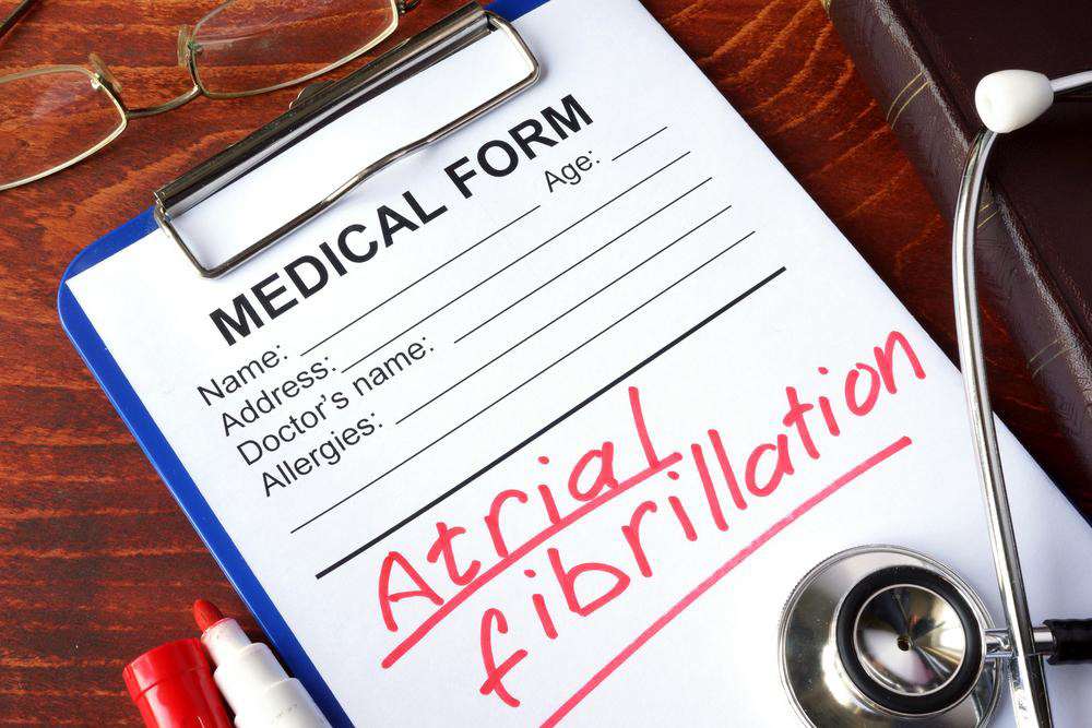 An overview of Atrial Fibrillation