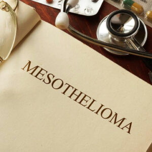 Everything you should know about Mesothelioma