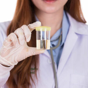 Here’s what you need to know about e coli in urine