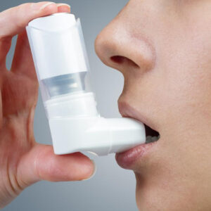 How is severe asthma treated?