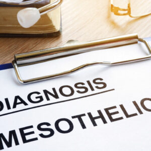 4 Effective Methods for Treating Mesothelioma