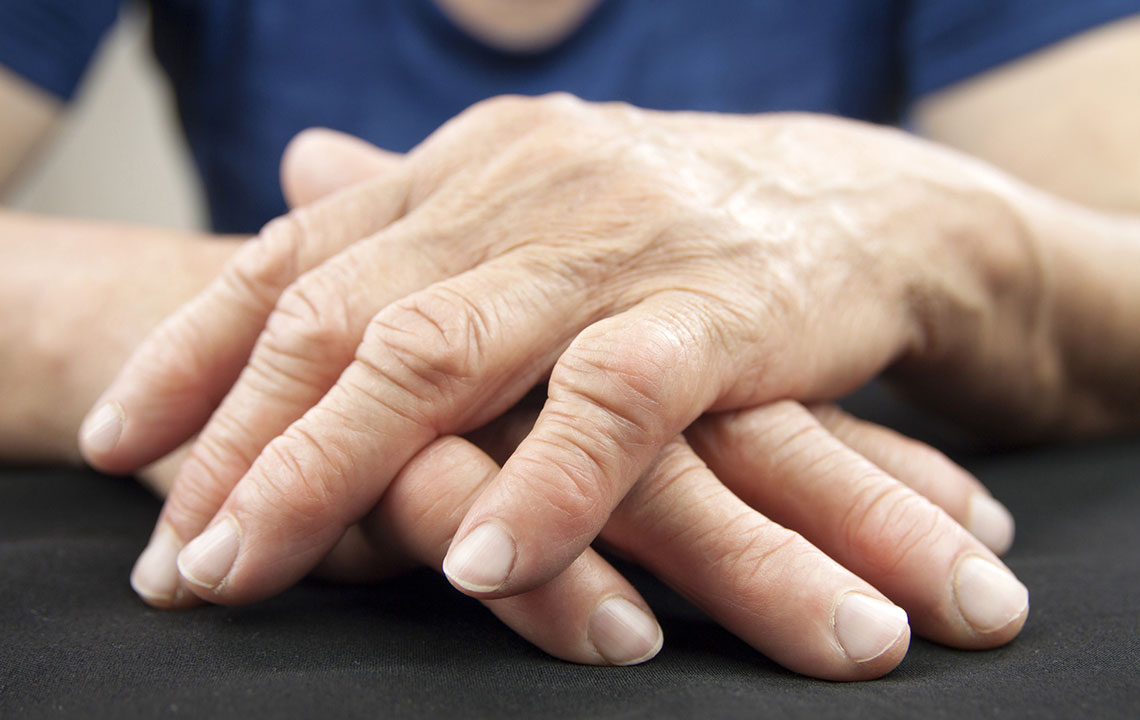 6 Ways to Manage the Symptoms of Arthritis