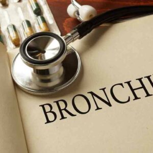 7 Methods for Treating Chronic Bronchitis