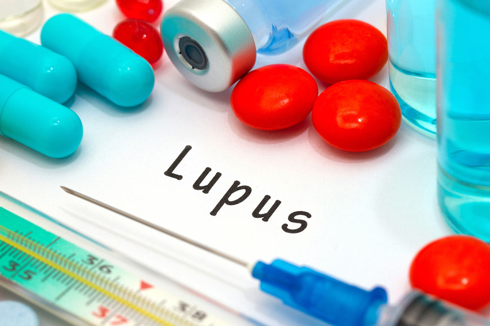 7 common symptoms of lupus