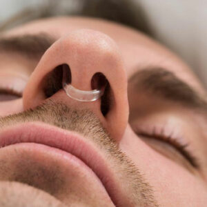 10 Things You Need to Know about Anti Snoring Devices