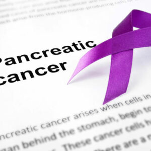 Basic Facts You Should Know On Treatment Of Stage 4 Pancreatic Cancer