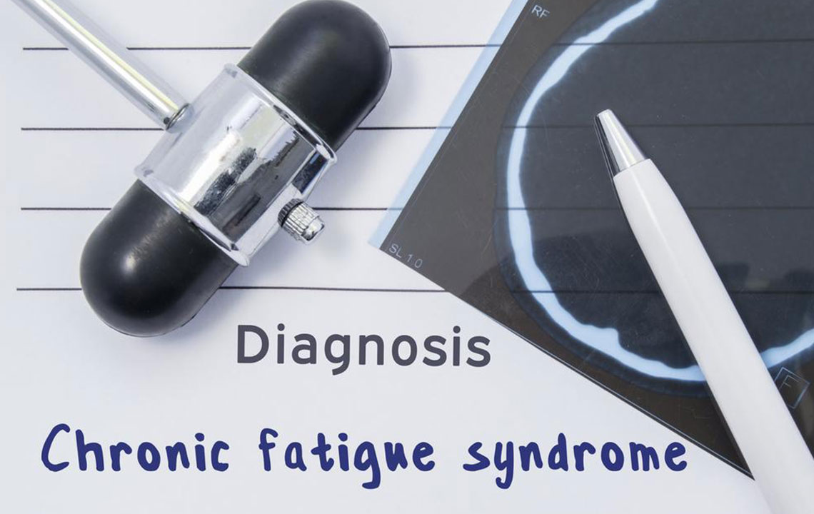 Causes, Symptoms, and Treatments for Chronic Fatigue Syndrome