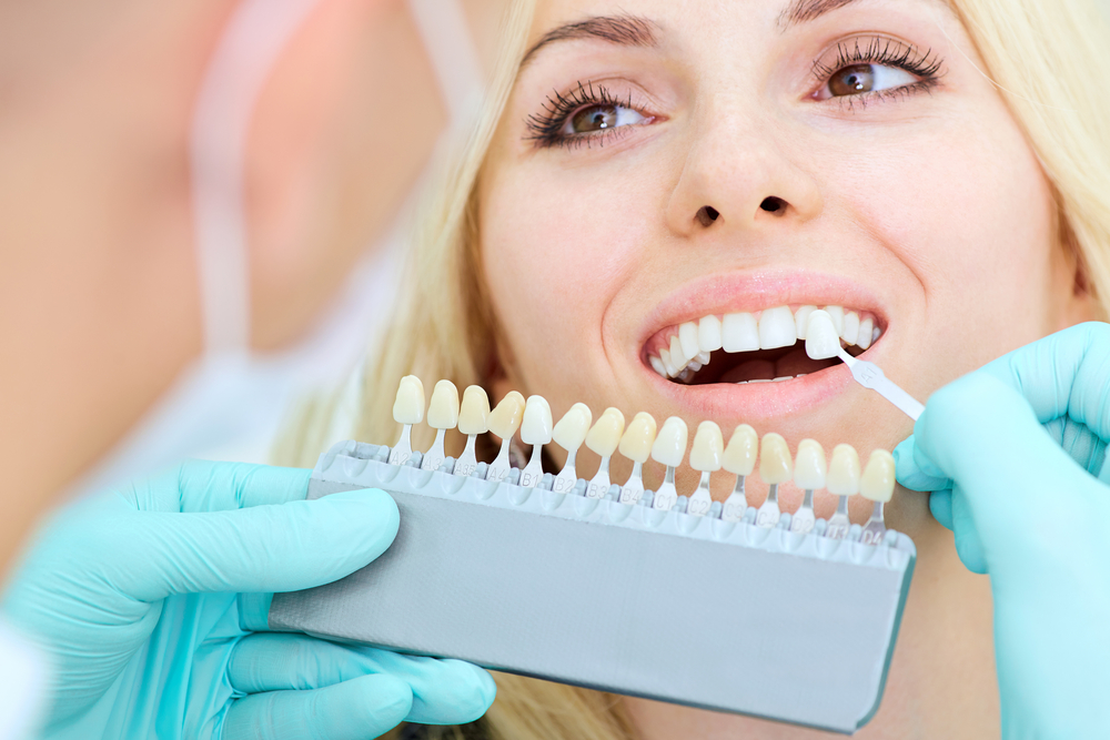 Everything You Need To Know About Dental Implants