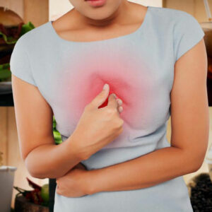 Everything You Need to Know About Heartburn