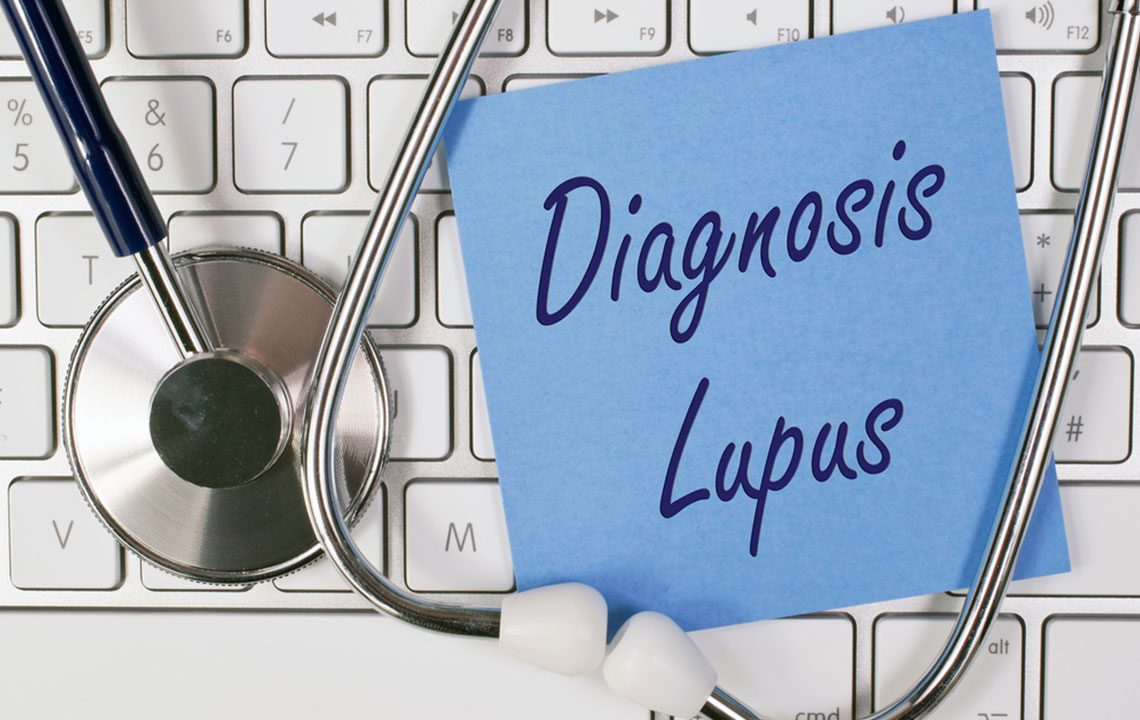 First Symptoms of Lupus to Watch Out For