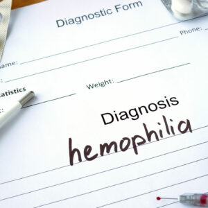 Three Factors to Consider While Living with Hemophilia