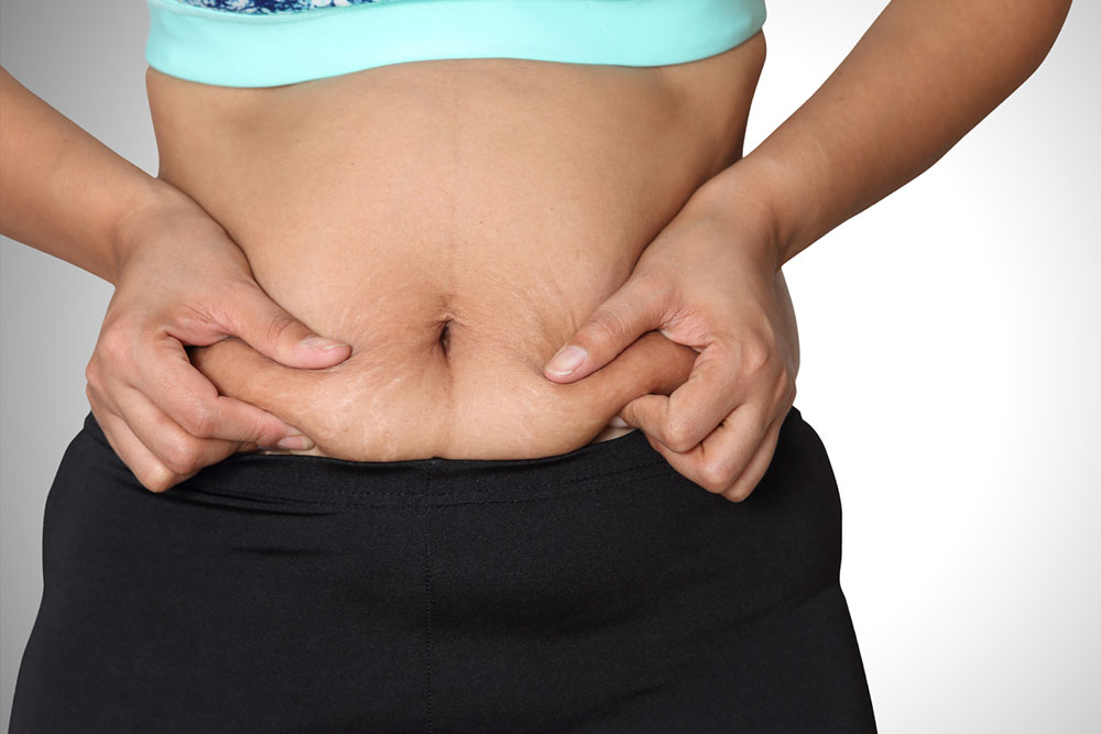 Tips to Lose Stubborn Belly Fat